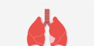 RCA: journée mondiale de lutte contre la tuberculose et son importance